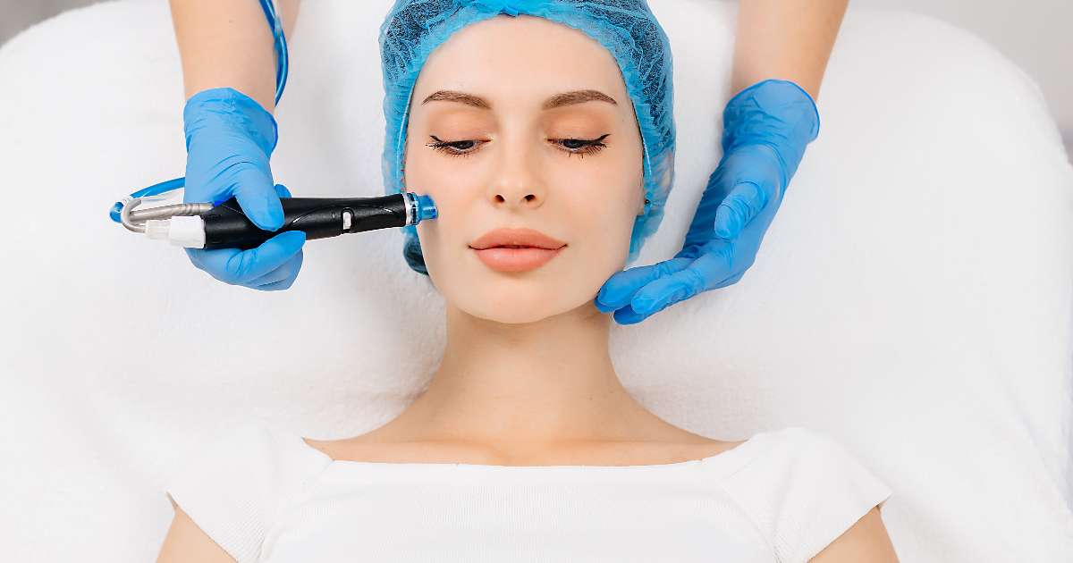 Woman receiving a professional microneedling treatment in Memphis, TN from a skincare specialist